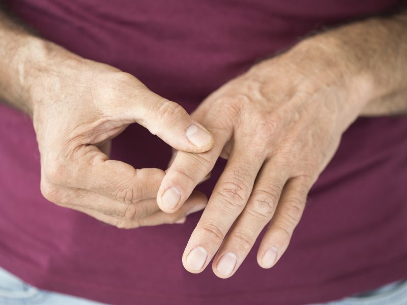 finger arthritis platelet rich plasma orlando hand surgery